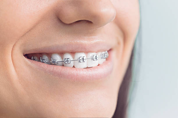 Best Traditional Braces  in Sneads, FL